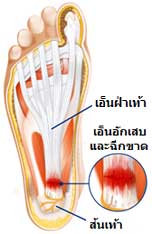 ภาพจาก LOCAL Podiatry