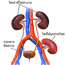 ภาพตั้งต้นจาก Wikipedia