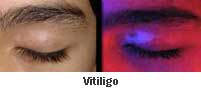 ภาพจาก Vit Happens